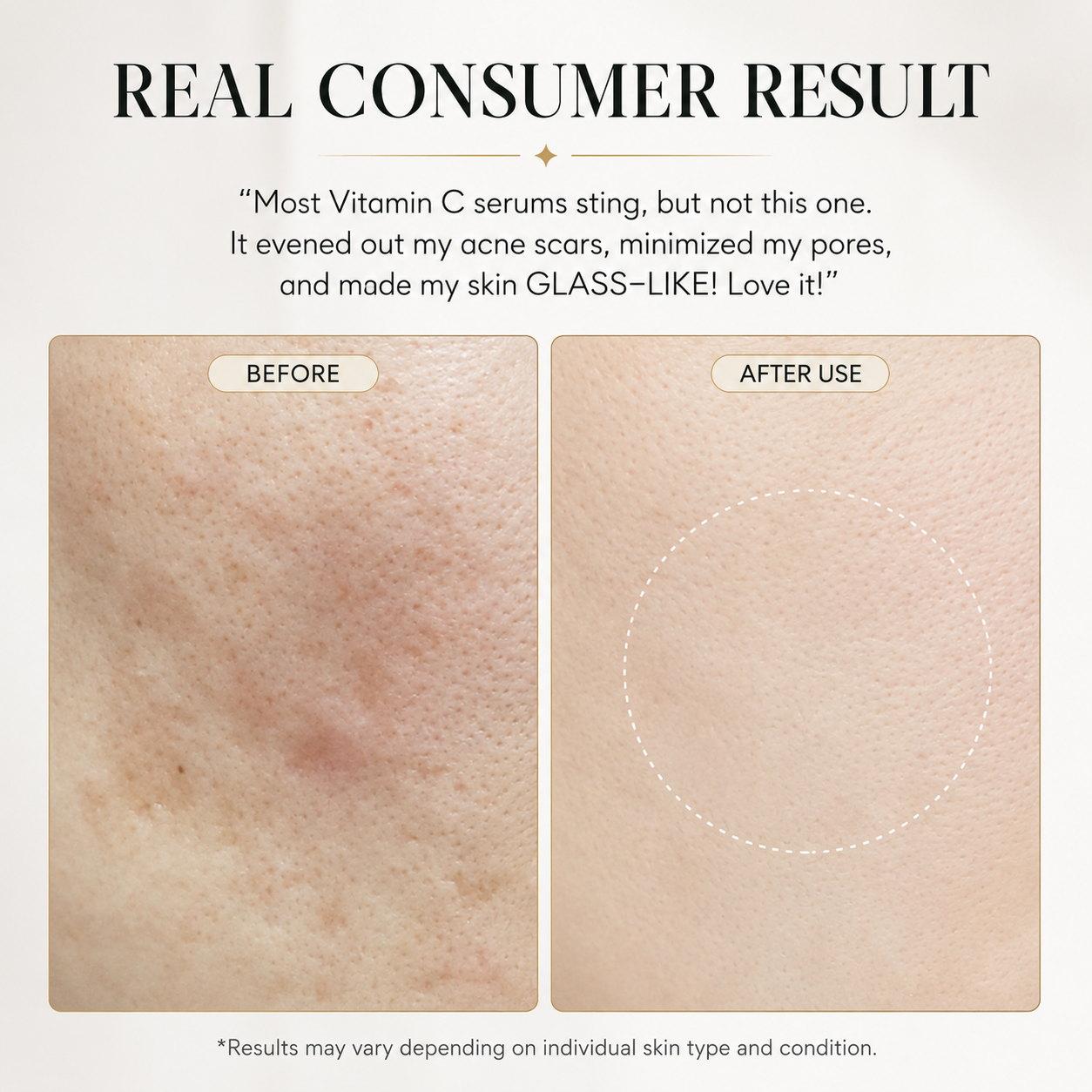 Pure Vitamin C & Glutathione Booster Serum for Radiant, Healthy-Looking Skin, 1.01 fl oz