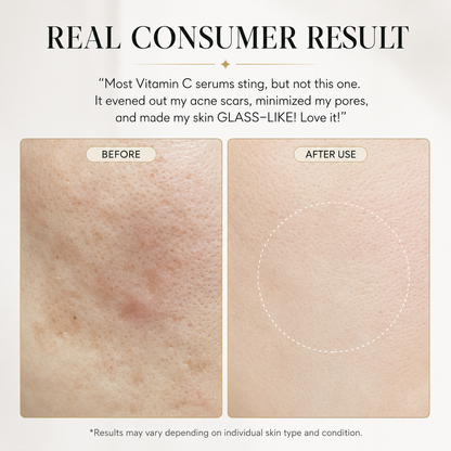Pure Vitamin C & Glutathione Booster Serum for Radiant, Healthy-Looking Skin, 1.01 fl oz