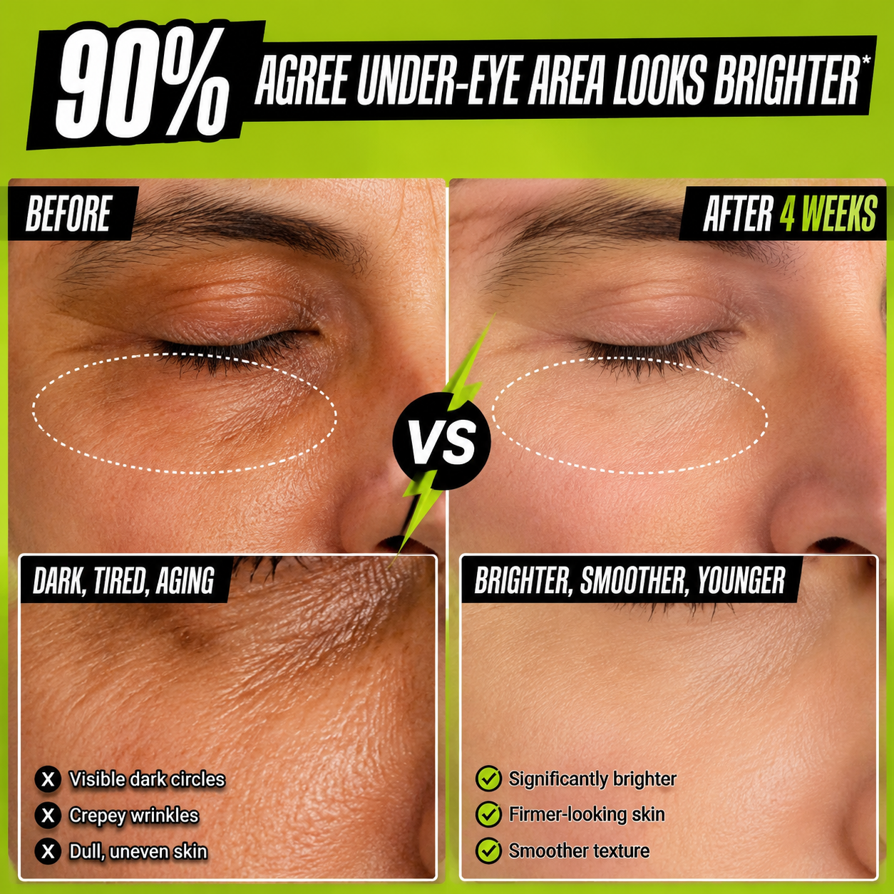 Jelenevia Avocado Eye Cream – Hydrating Under-Eye Treatment for Puffiness,😍 Dark Circles & Fine Lines😍