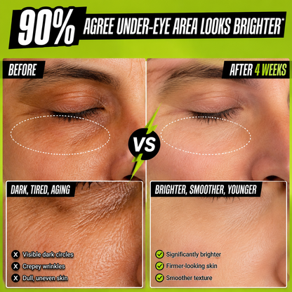 Jelenevia Avocado Eye Cream – Hydrating Under-Eye Treatment for Puffiness,😍 Dark Circles & Fine Lines😍