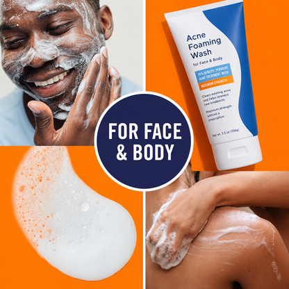 10% Benzoyl Peroxide Foaming Face & Body Cleanser – Maximum Strength Daily Wash for Acne-Prone Skin, Helps Remove Excess Oil and Pore Buildup, 5.5 oz